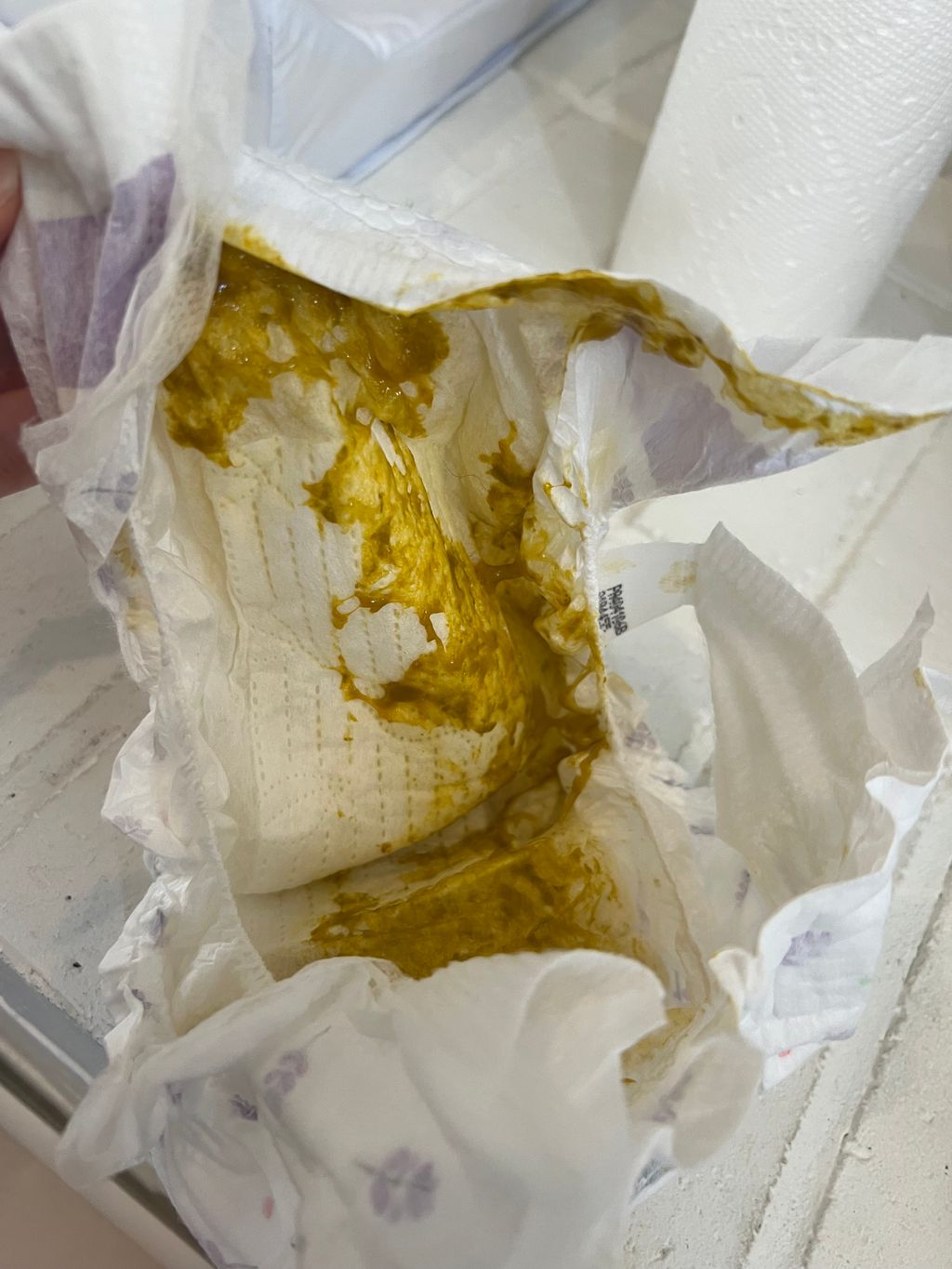 Blood in stool? laryngomalacia / acid reflux / allergy? Pic included