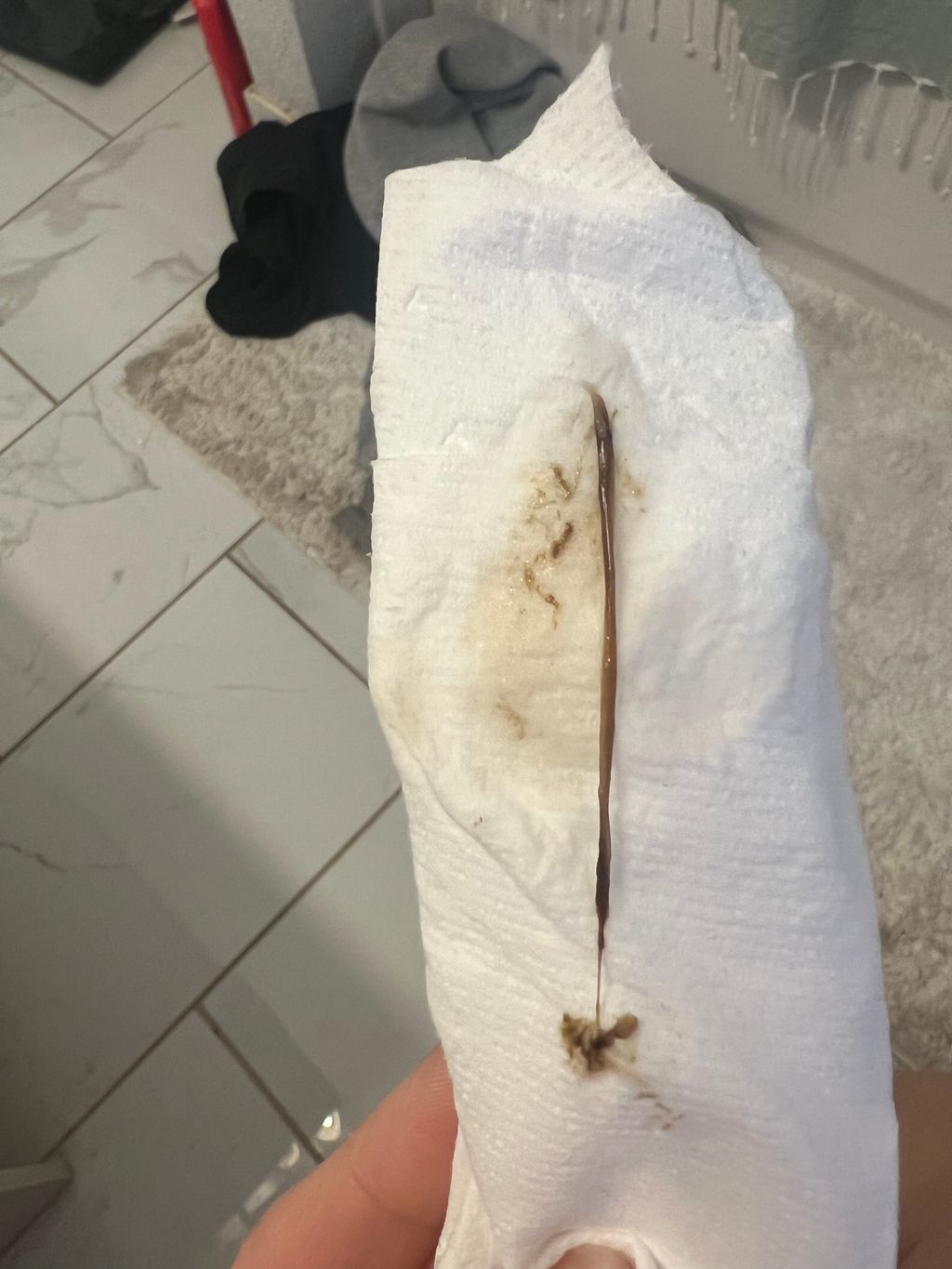 Thick Brown Mucus (PIC) 8 weeks 1st Trimester Experiences Forums