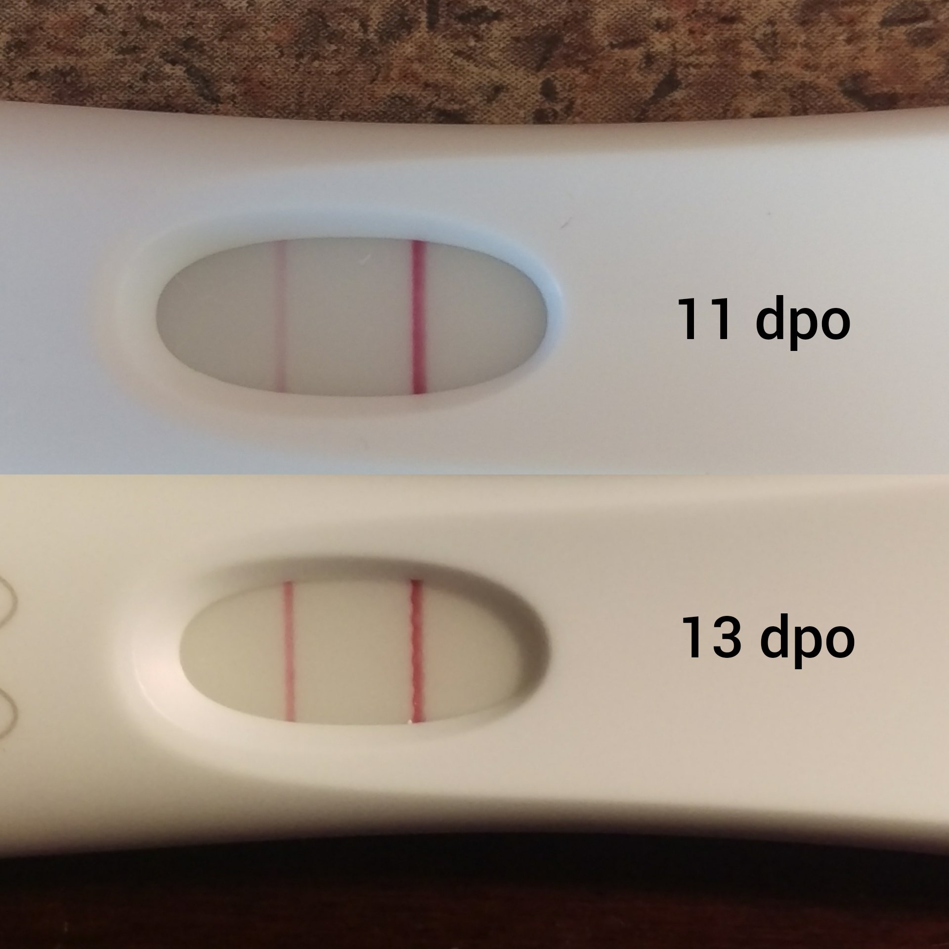 Ectopic Pregnancy Test Progression pregnancy test