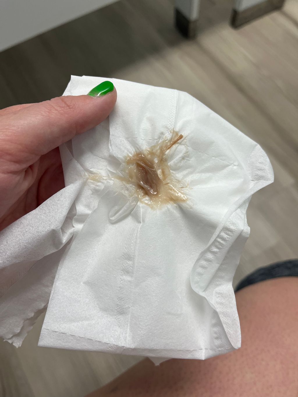 36+4 losing mucus plug - June 2024 Babies | Forums | What to Expect