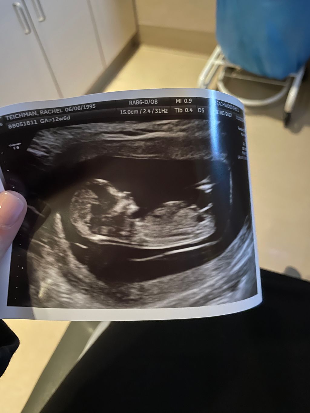 Boy Or Girl?! Based On Nub Theory 12 Week Ultrasound, 46 OFF