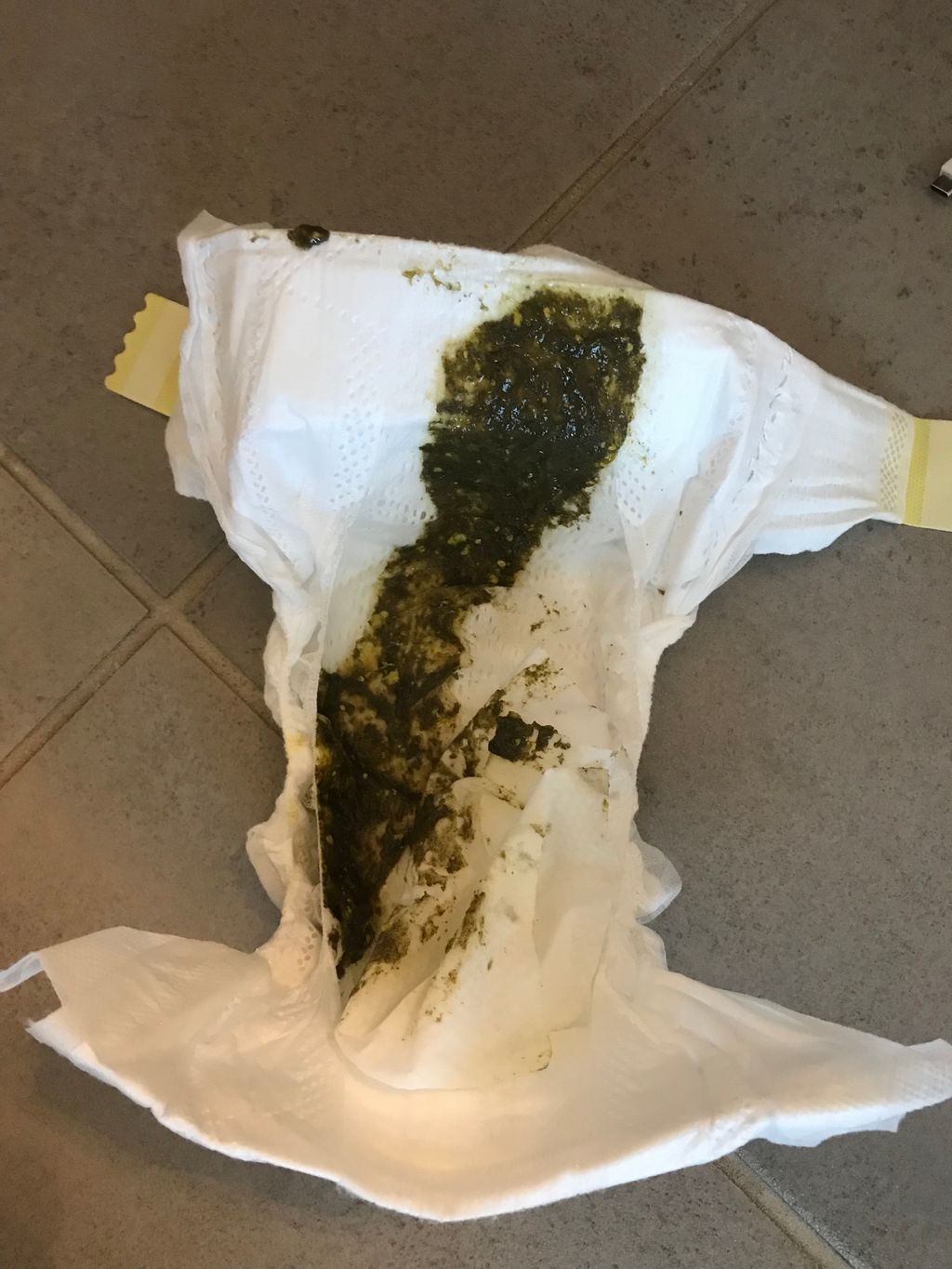 6 month old poop pics (sorry!) April 2021 Babies Forums What to Expect