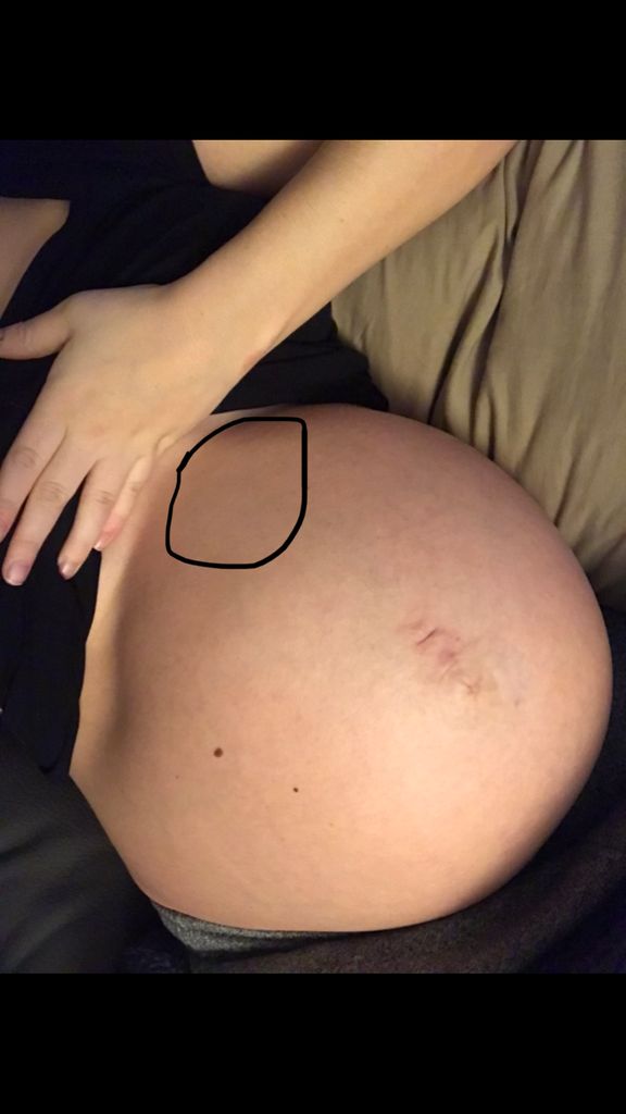Pregnant Belly Feels Bruised Captions More