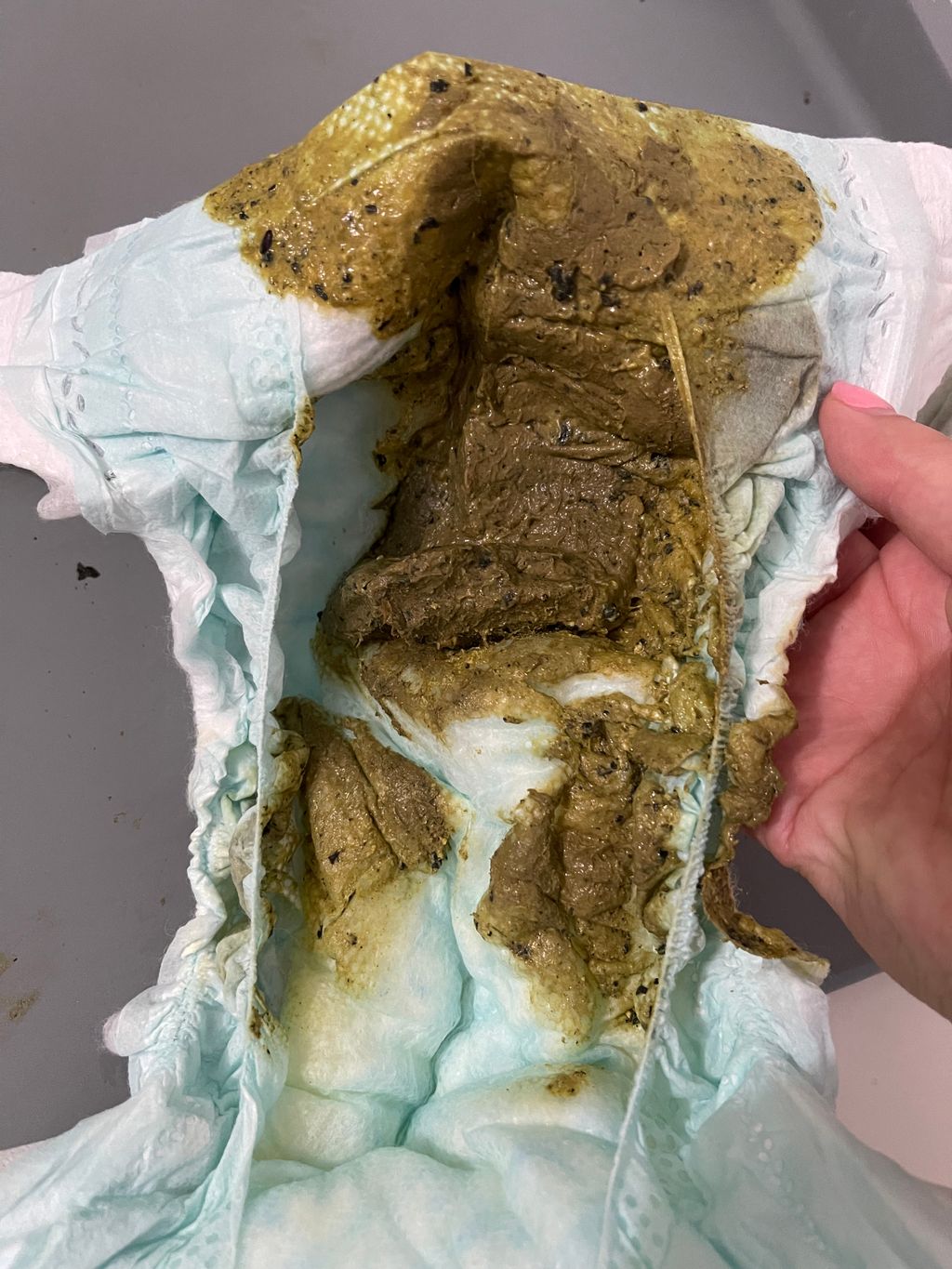 ** poop pic black spots in poop July 2023 Babies Forums What to