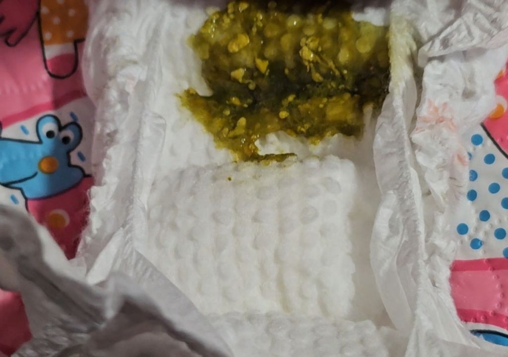 Green poop breastfeeding baby 3weeks old June 2024 Babies