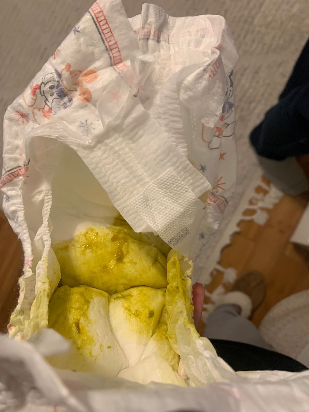 Teething and diarrhea? January 2024 Babies Forums What to Expect