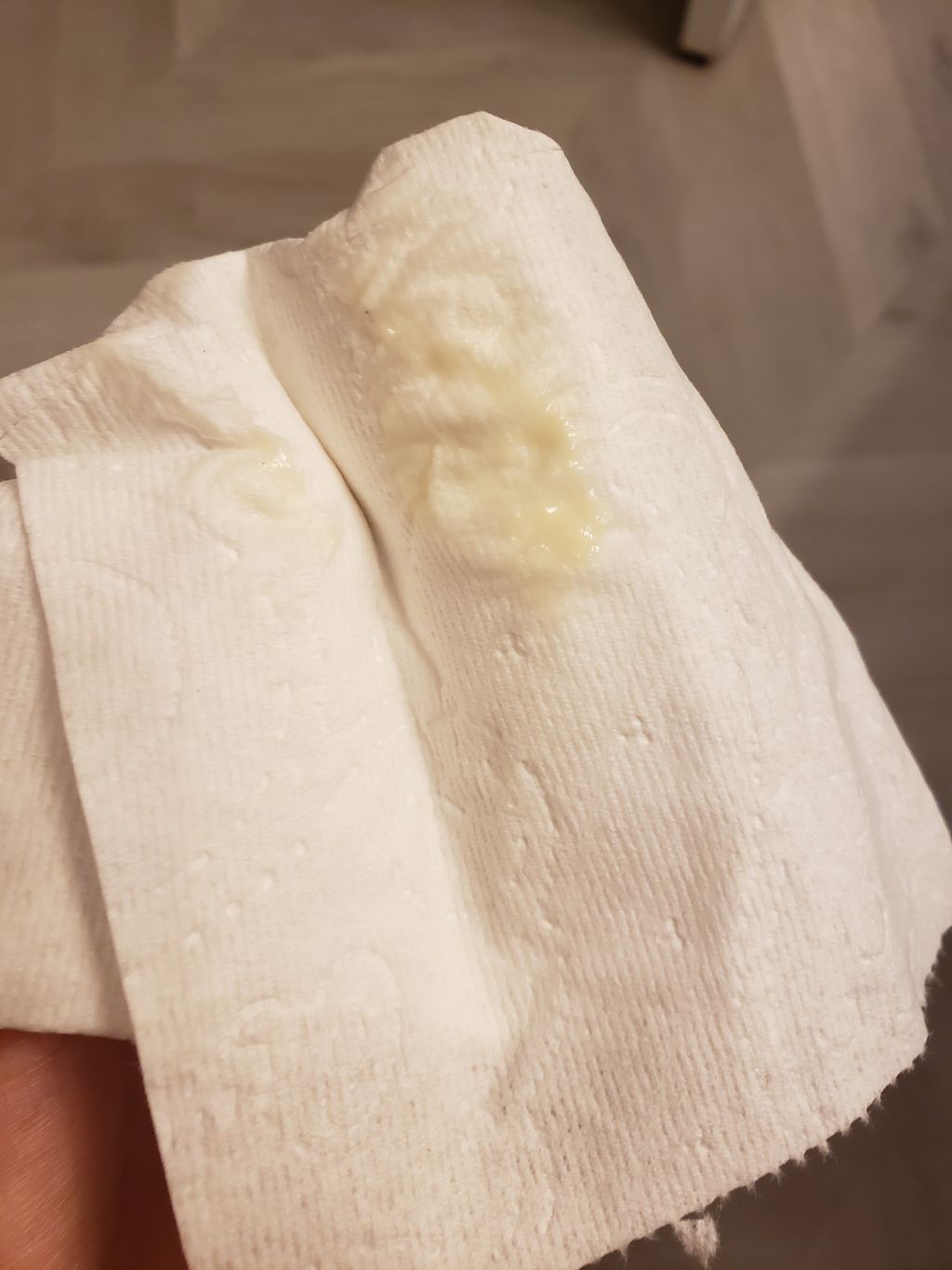 Light green discharge 1st Trimester Experiences Forums What to Expect