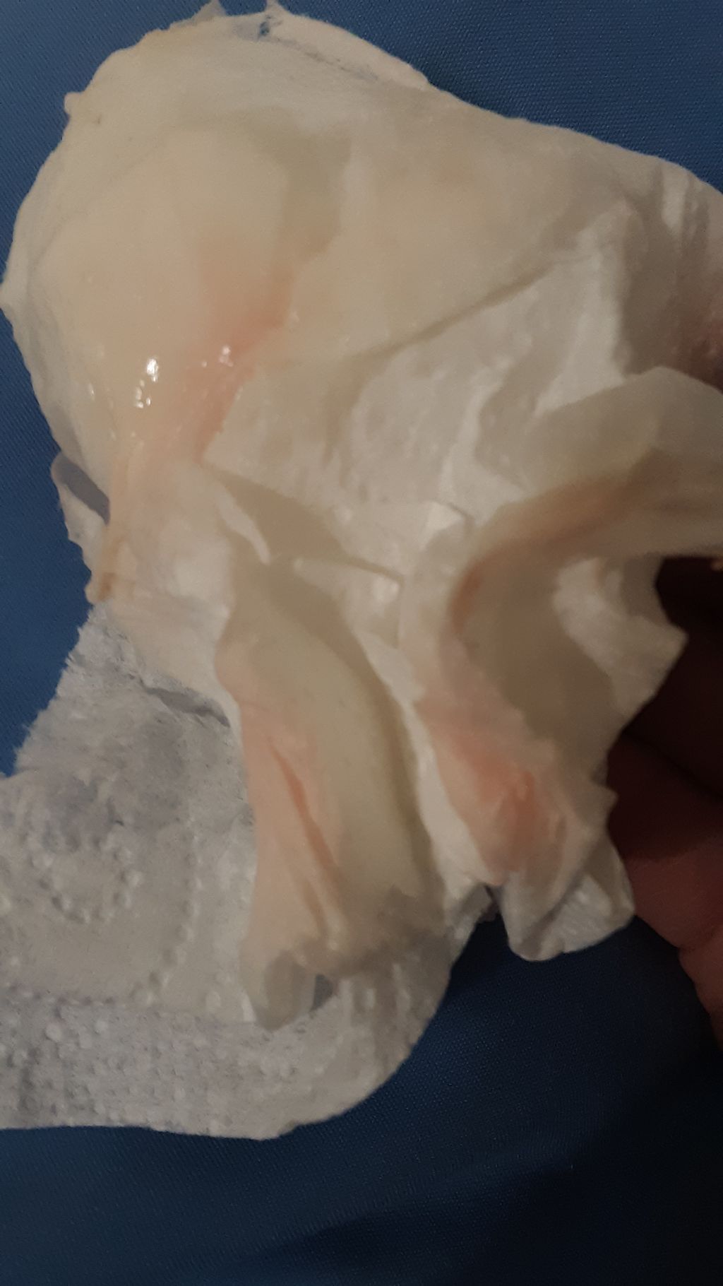 Light Pink Blood In Discharge 38 Weeks Pregnant