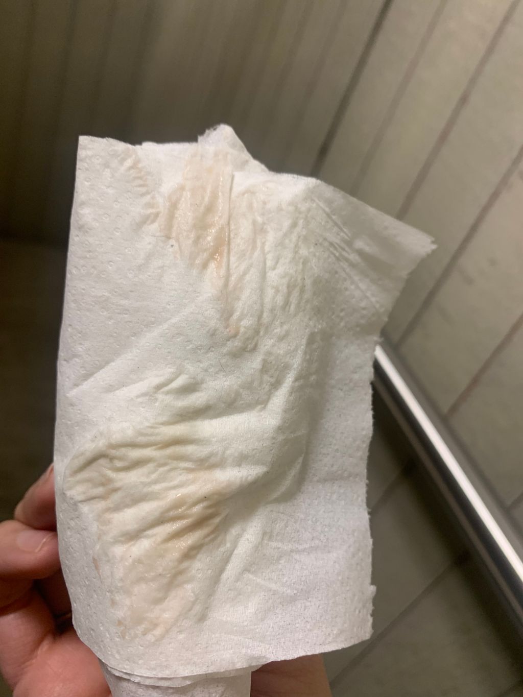 Pinkish/brownish discharge 45 dpo? TMI PHOTOS Trying to Conceive