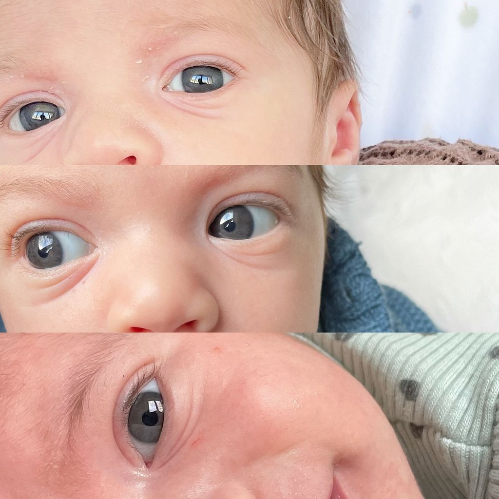 Baby Eye Color Change Progression Pictures Help Guides in 2024