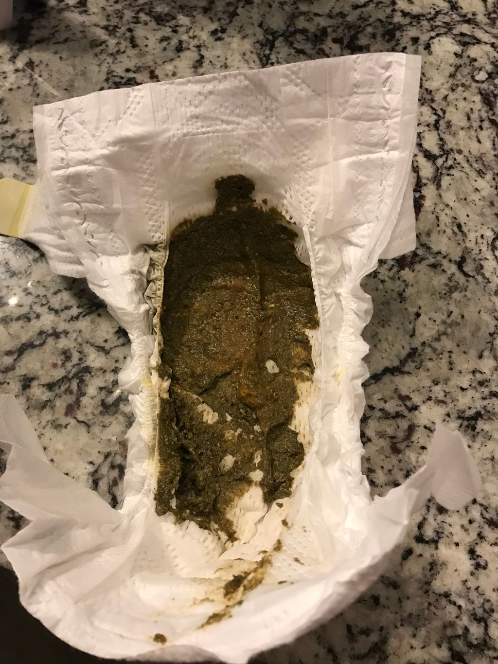 6 month old poop pics (sorry!) April 2021 Babies Forums What to Expect