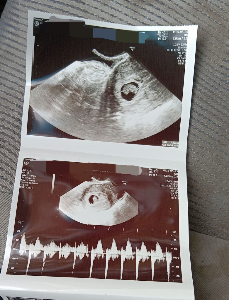 Advice from me, an ultrasound technologist June 2025 Babies Forums