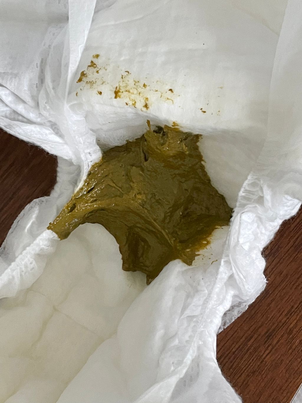 Cow Milk Allergy? (Poop Pic Included) Baby's First Year Forums