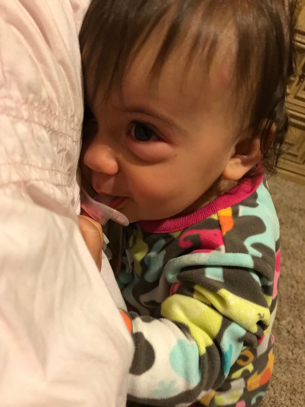 Baby Waking Up With Swollen Eye Hotsell forodelasartes.uchile.cl