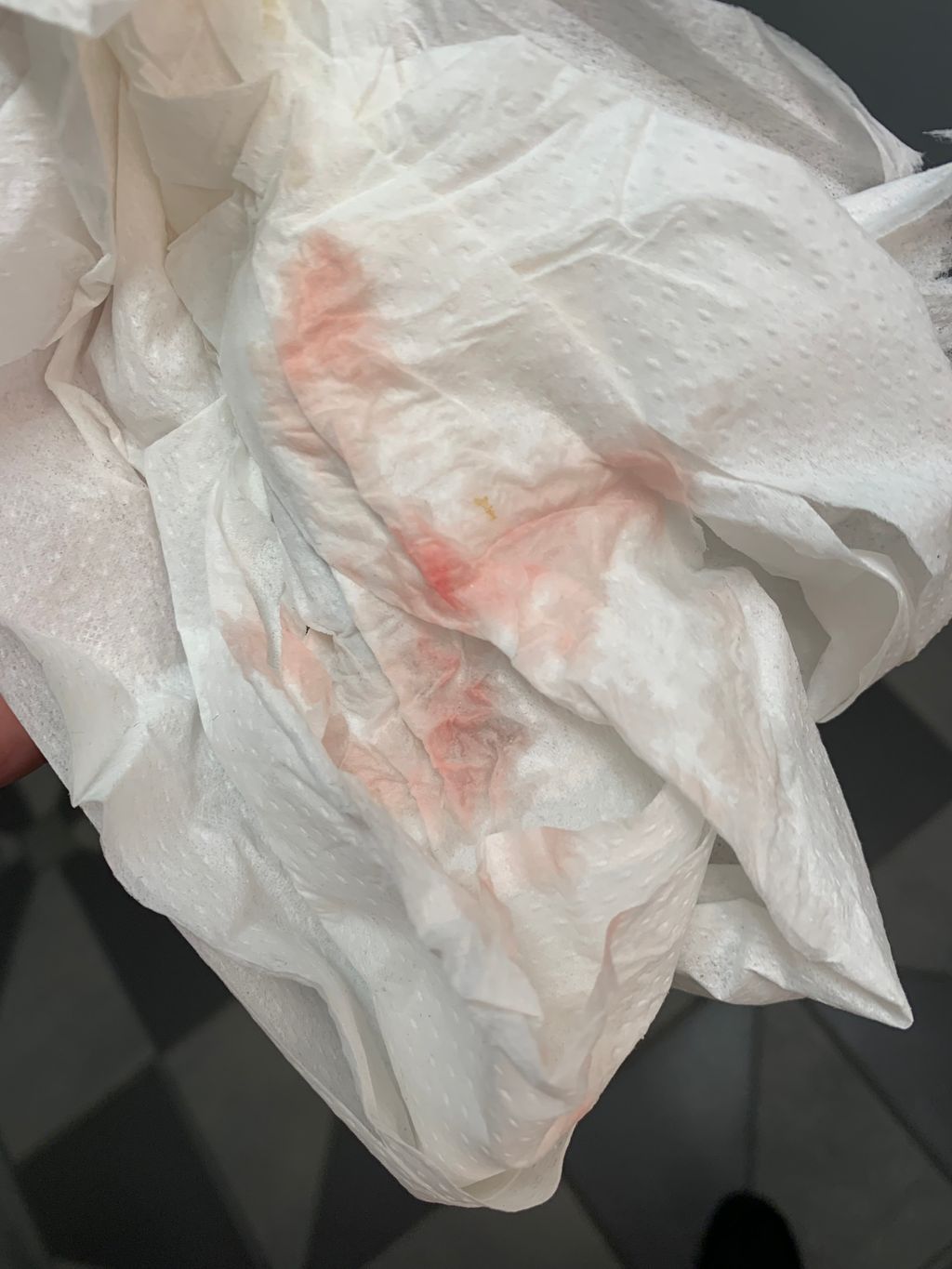 Light Blood When Wiping- 5 Weeks 4 Days - Fertility Treatments | Forums | What To Expect