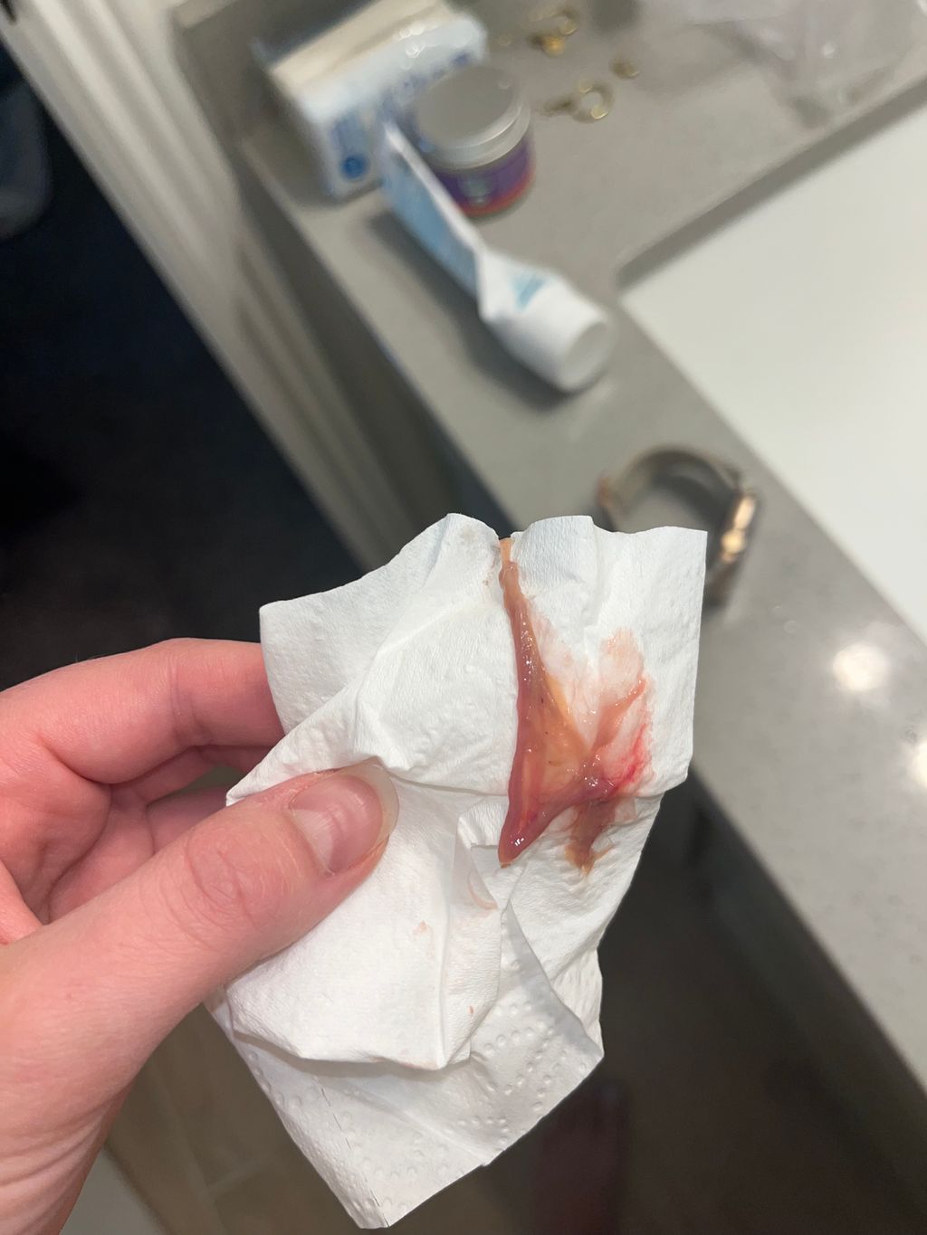 Passing Tissue Post D&C June 2024 Babies Forums What to Expect