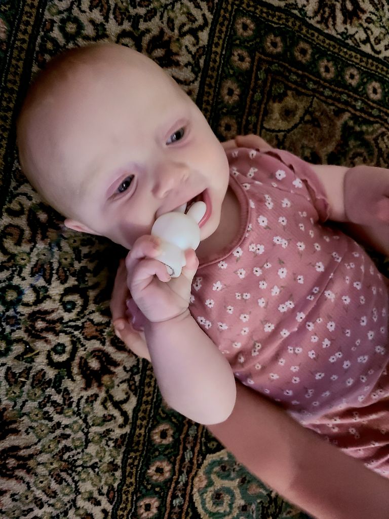 baby has really purple bags under eyes October 2021 Babies Forums