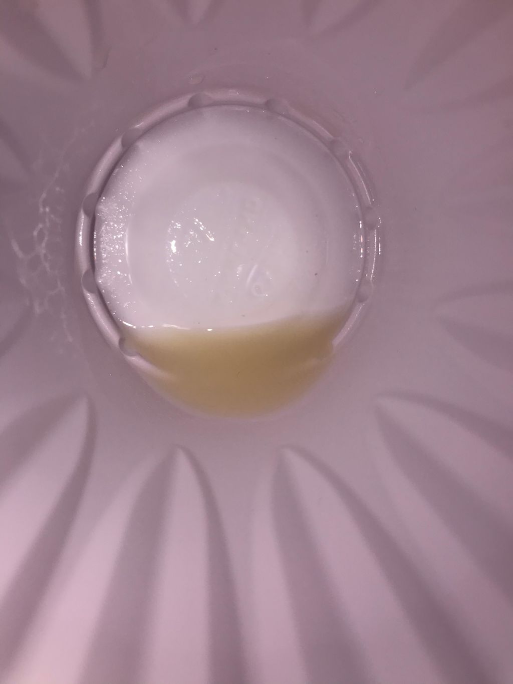 What Does Amniotic Fluid Look Like In Toilet