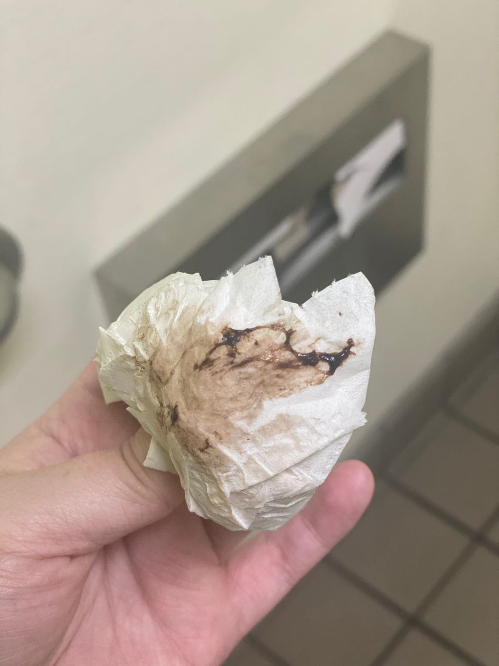 Brown Discharge Implantation Bleeding