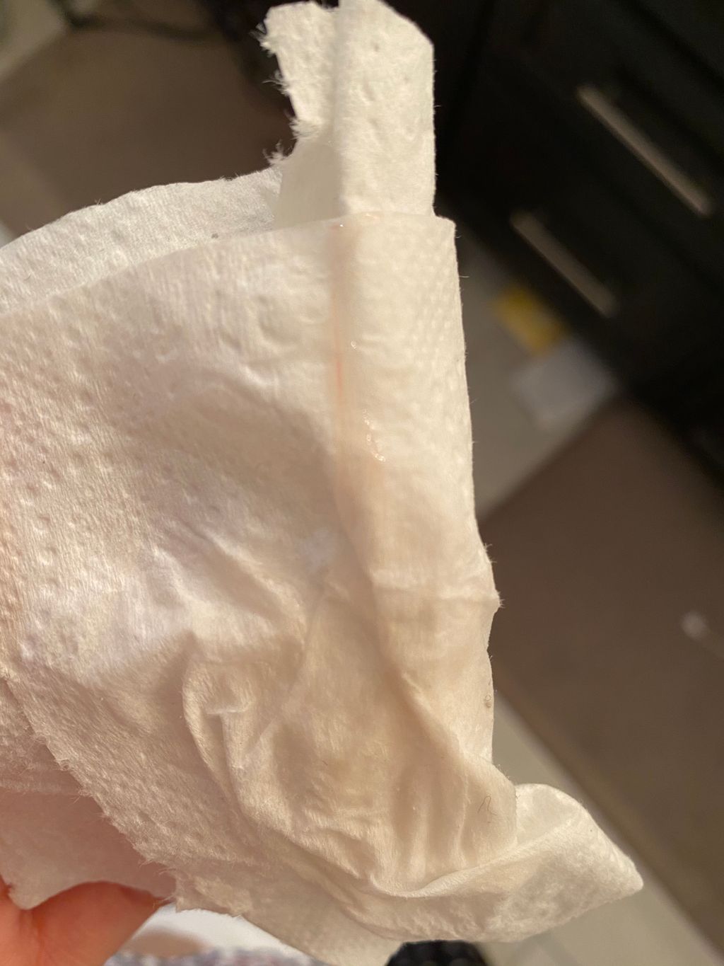 Light Pink Discharge During Pregnancy Second Trimester