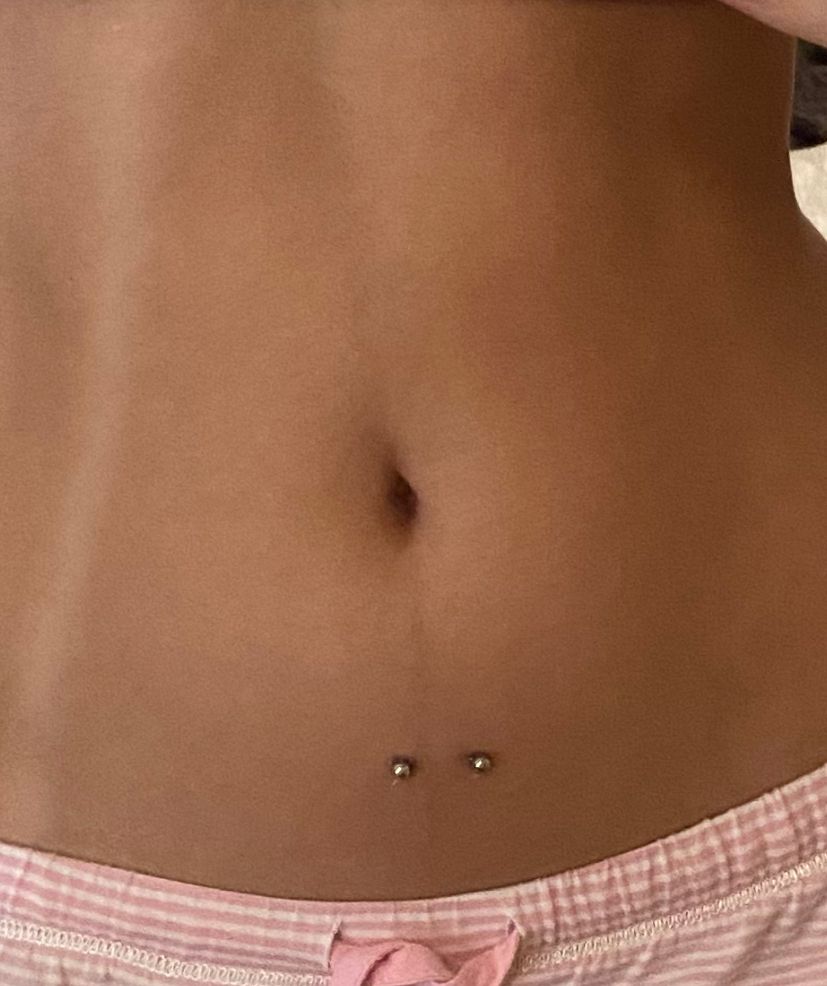 Navel Piercing Scar Removal