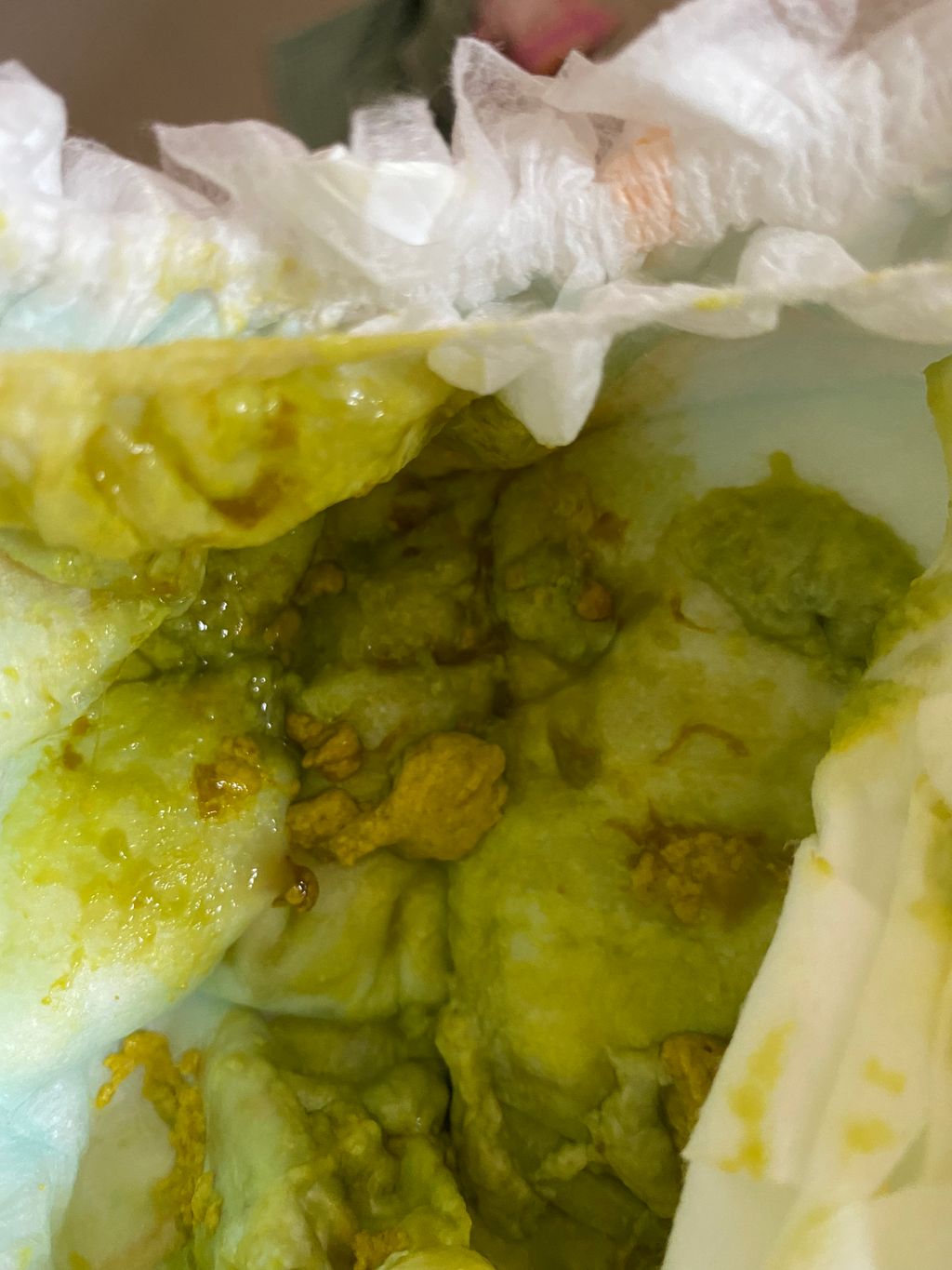 Light green poop in diarrhea Pic included October 2021 Babies Forums What to Expect