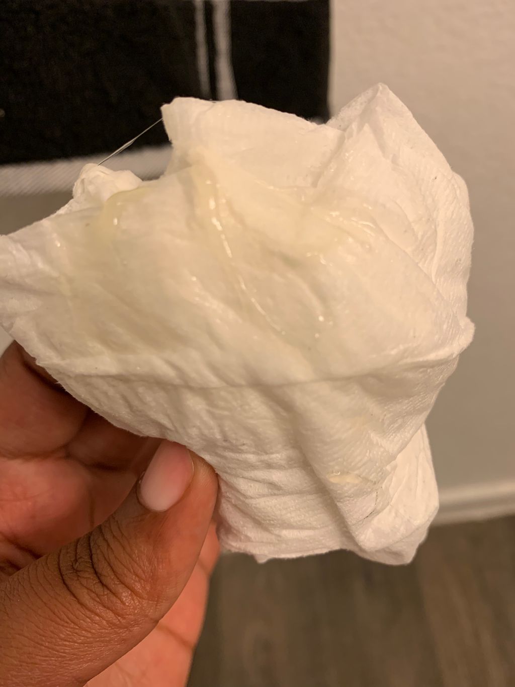 Mucus Plug Pregnancy