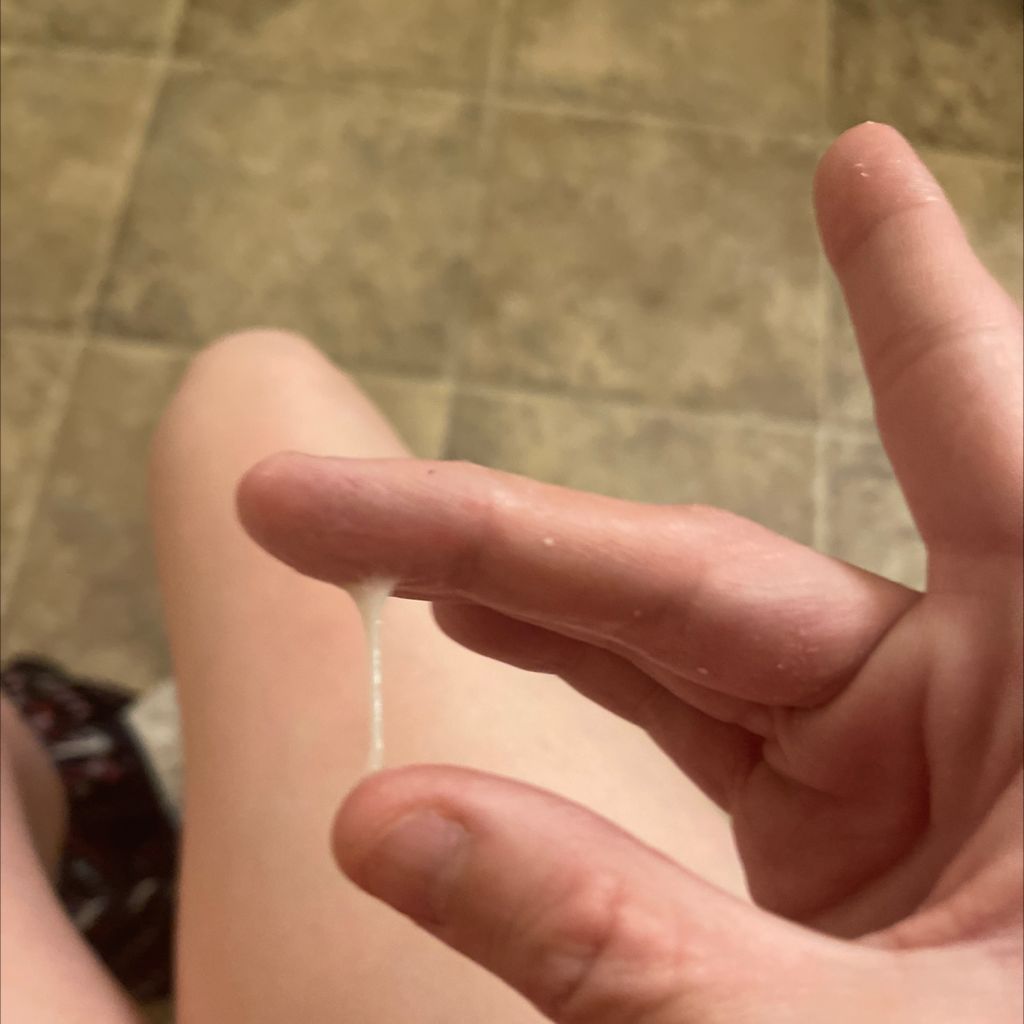 Is This Pregnancy Discharge - Trying To Conceive | Forums | What To Expect