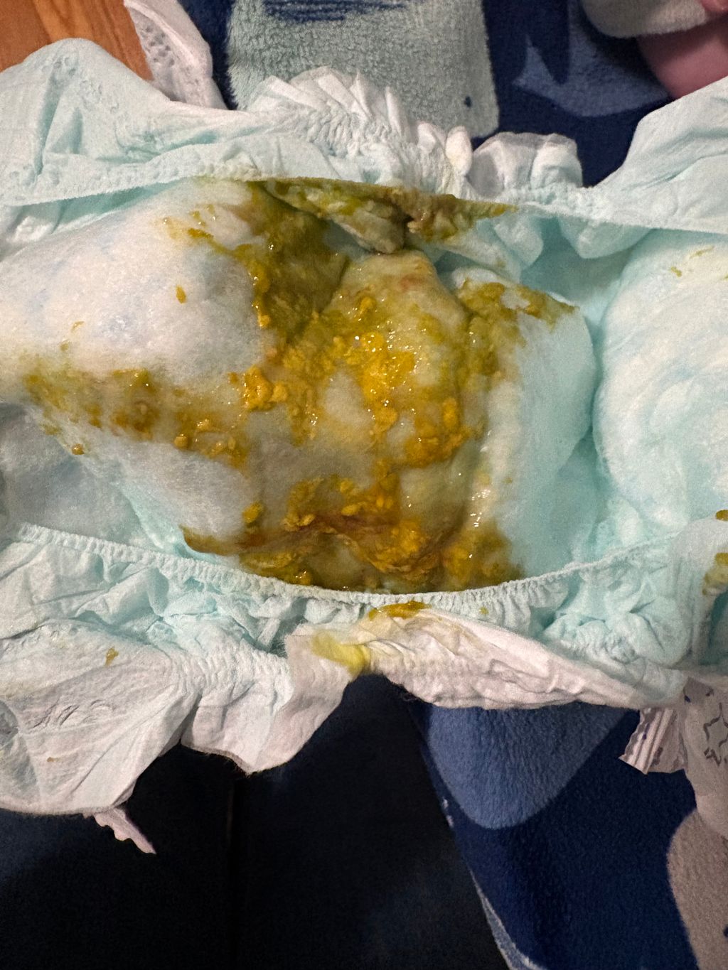 Possibly Cow milk allergy?? (Picture included) September 2024 Babies