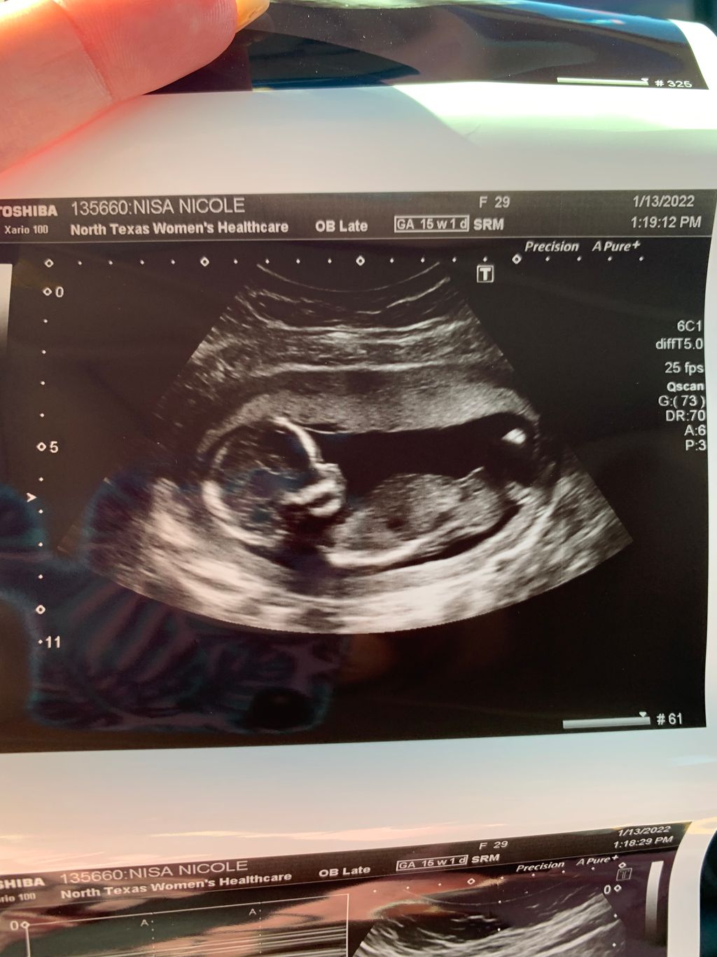 Pregnant Boy Ultrasound