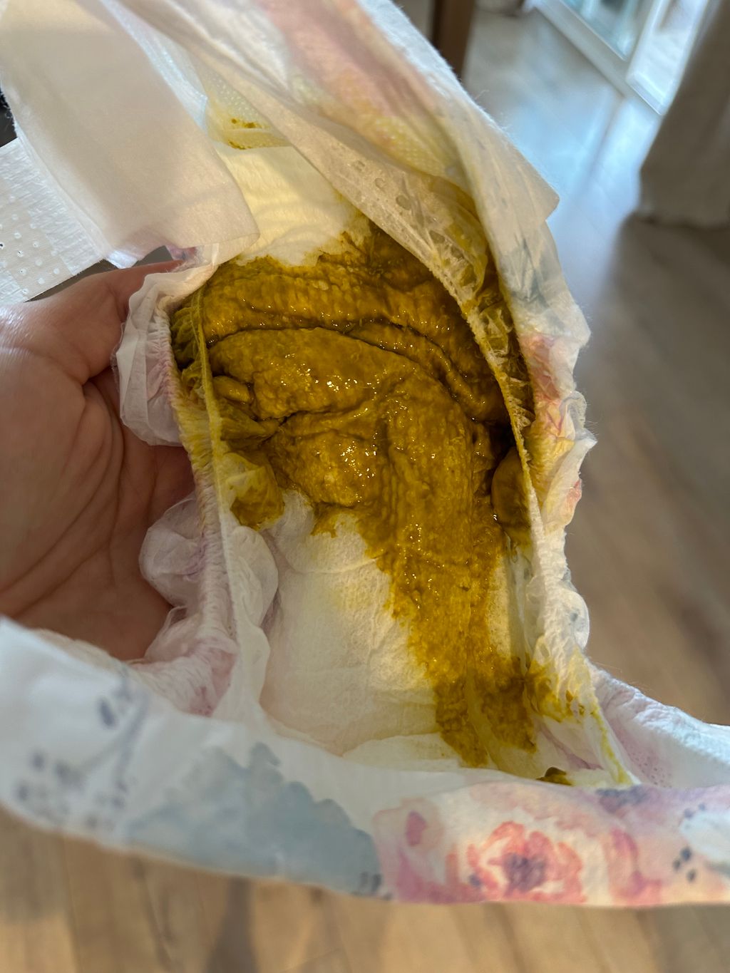 Is this normal breastfed baby poop? Breastfeeding Forums What to Expect