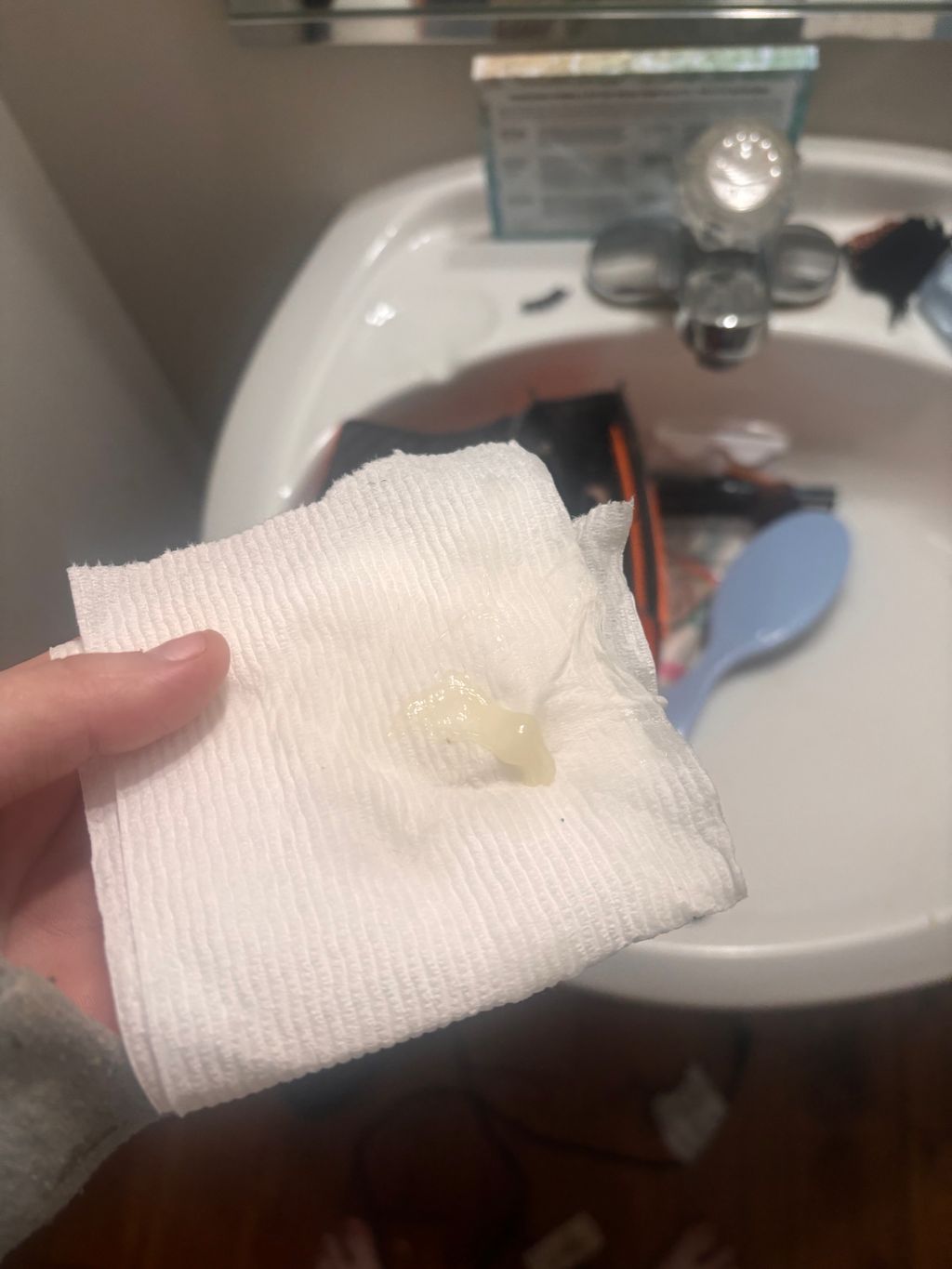 11weeks 5 days weird discharge May 2025 Babies Forums What to Expect