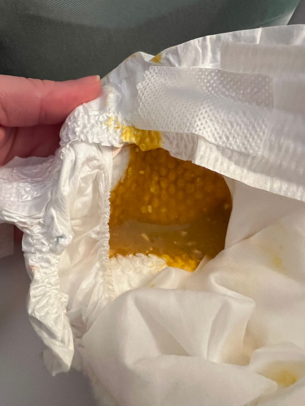 EBF poop dairy intolerance? March 2024 Babies Forums What to Expect