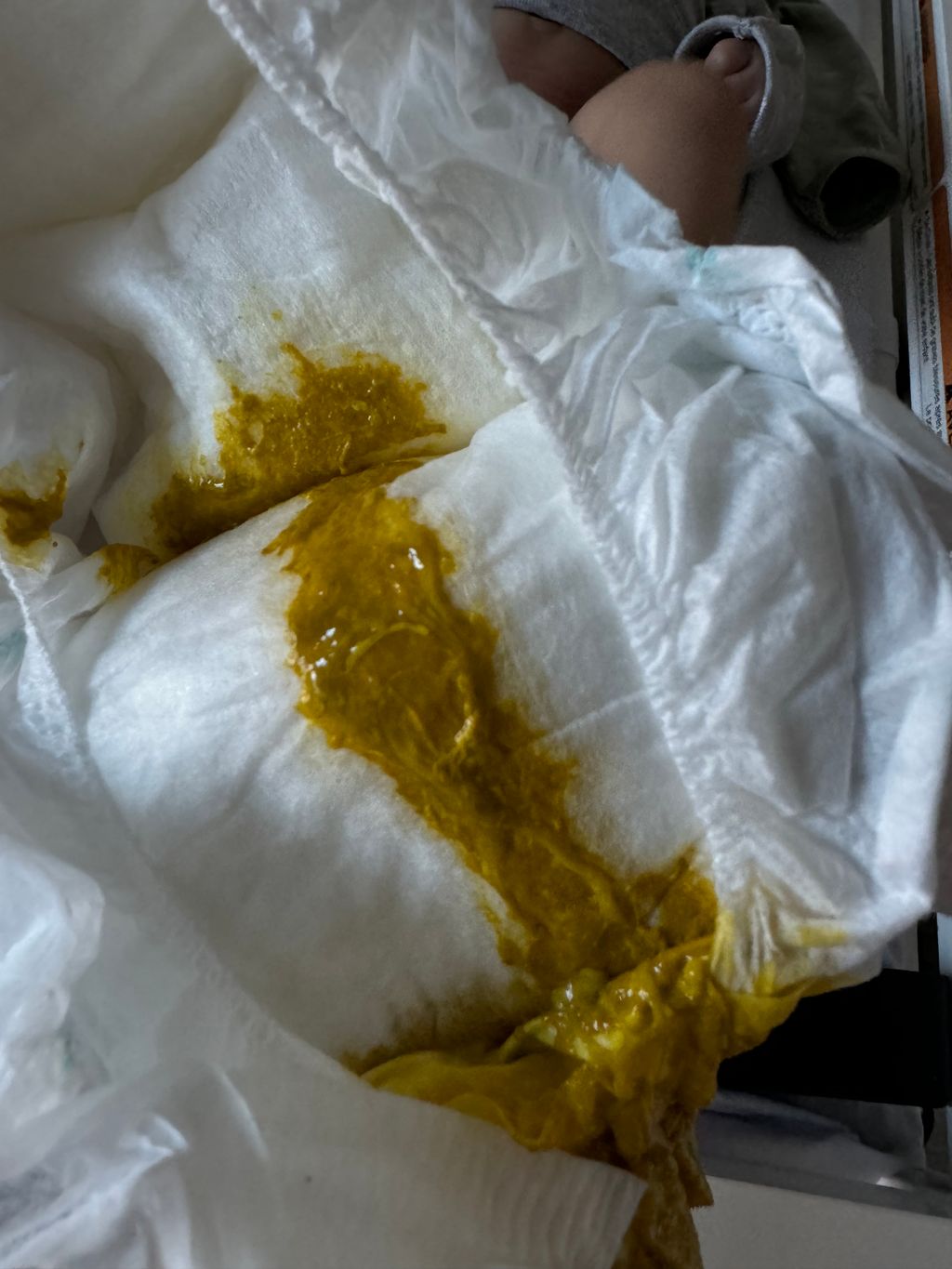 Is this poop normal? EBF September 2024 Babies Forums What to Expect