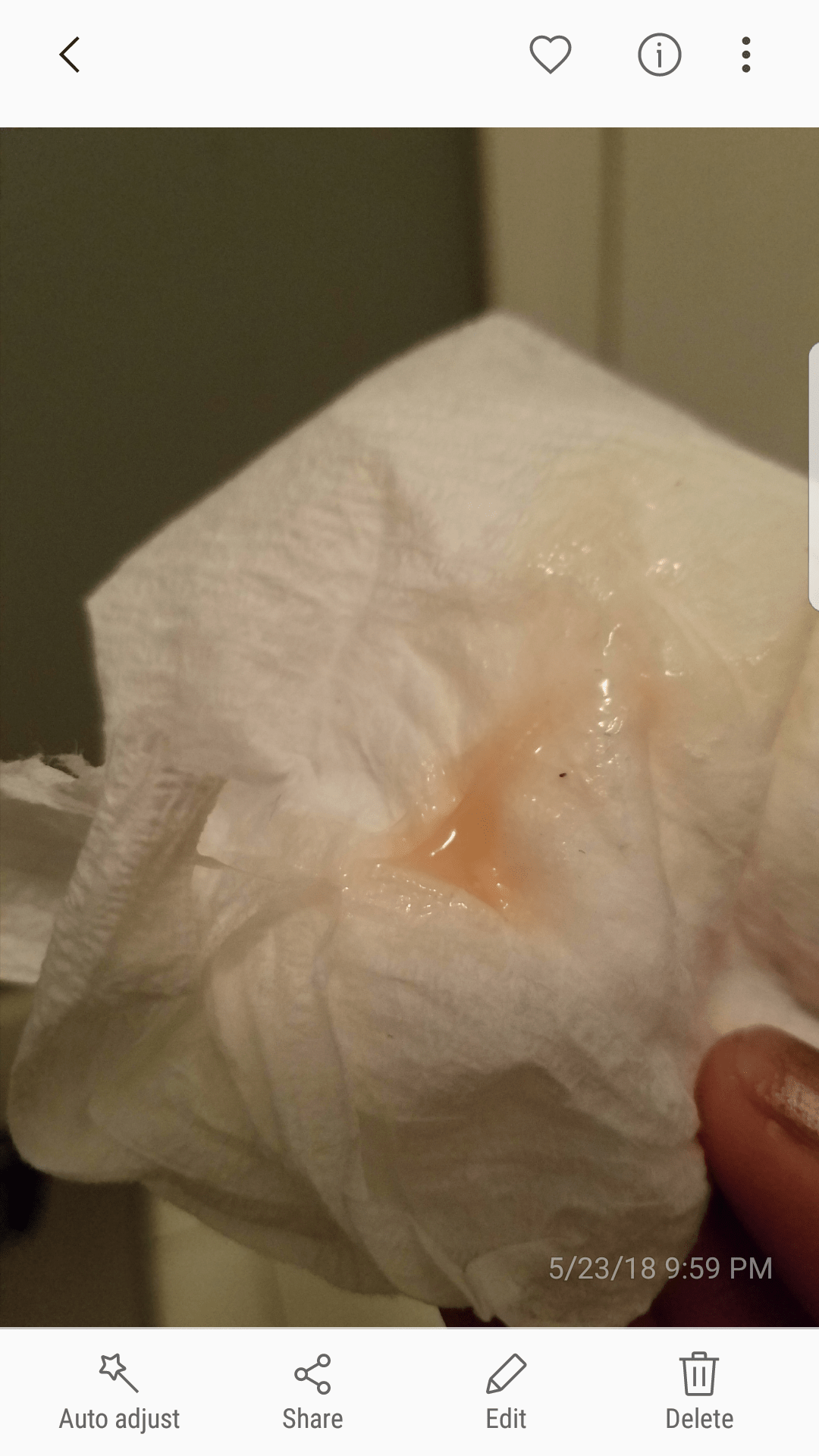 Implantation Bleed 13dpo maternity photos