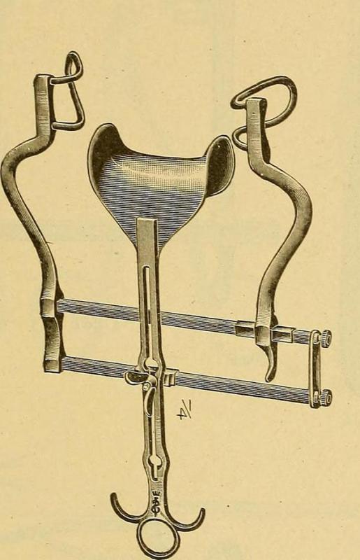 What is a Balfour Retractor? (with pictures)