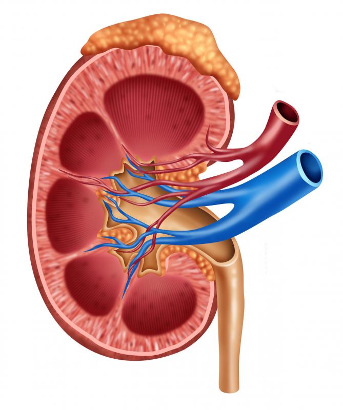 What is an Adrenal Nodule? (with pictures)