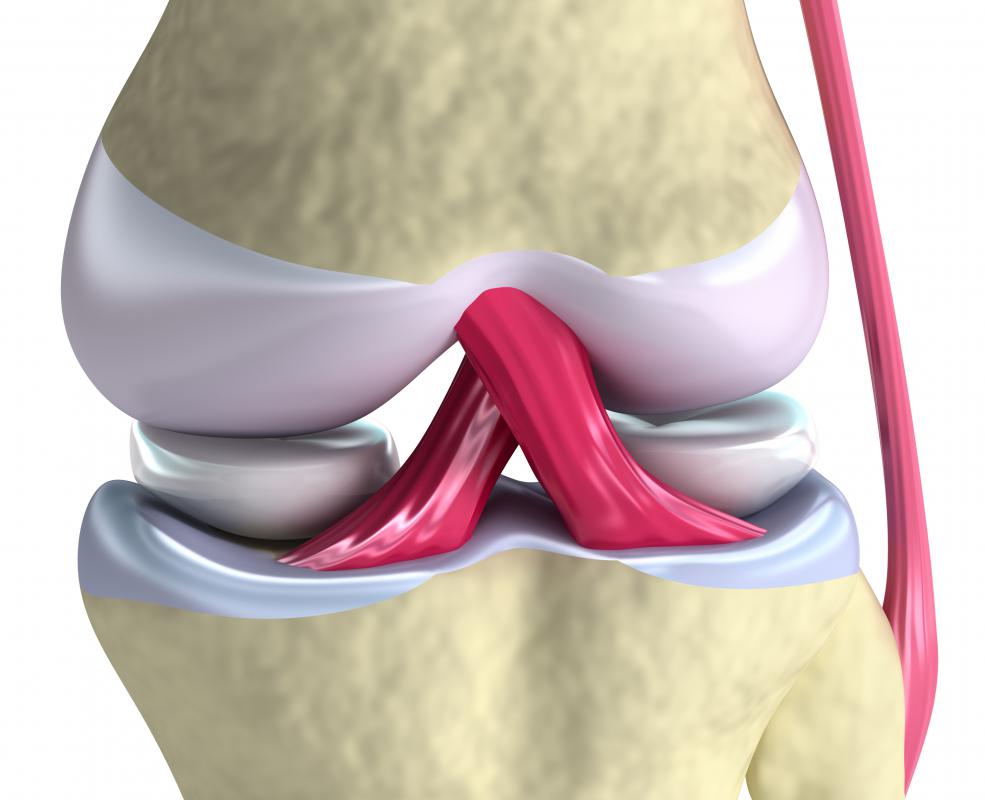 What is the Knee Joint? (with pictures)