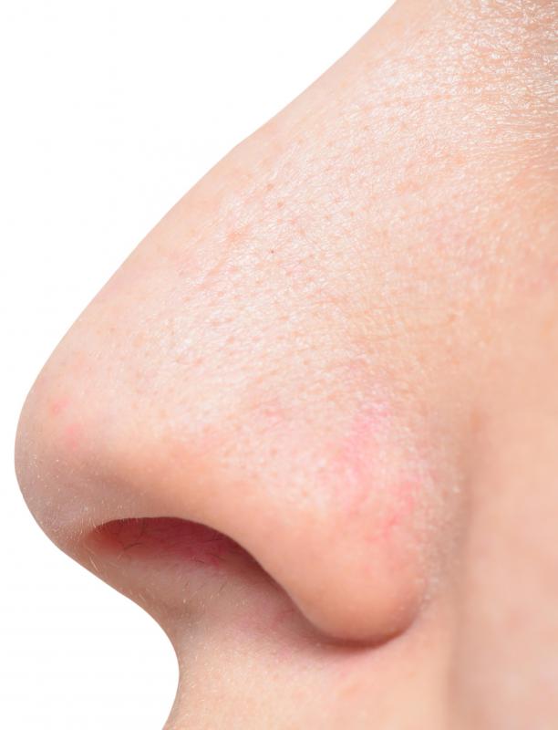 What Causes a Clogged Nostril? (with pictures)