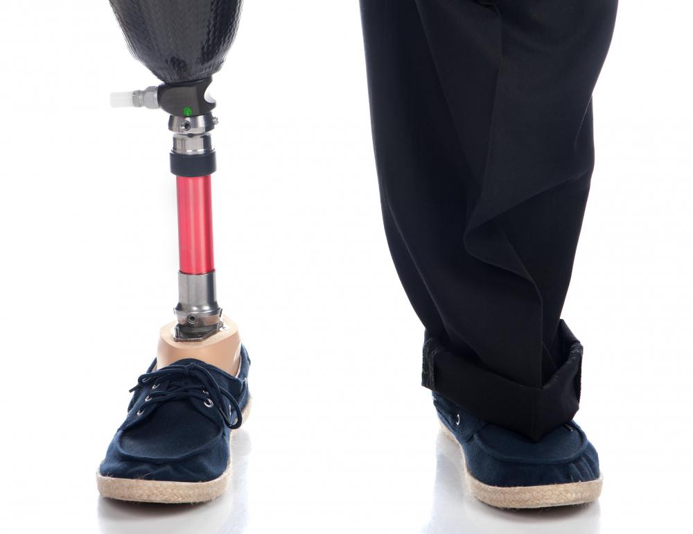 What is a Prosthetic Foot? (with pictures)