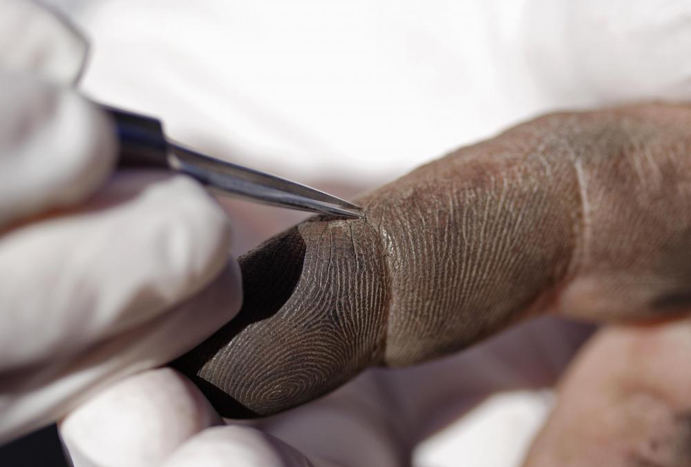 What Is a Tweezer Tool? (with pictures)