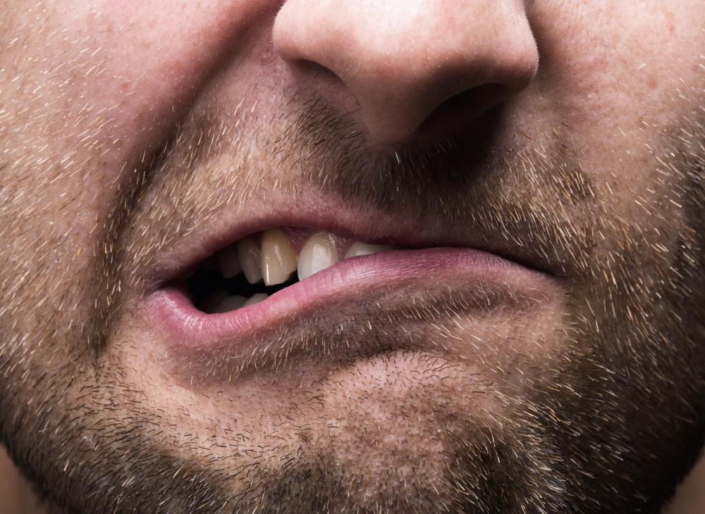 What are the Causes of Loose Teeth in Adults? (with pictures)