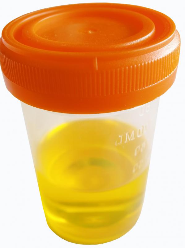 What Is a Urethral Swab? (with pictures)