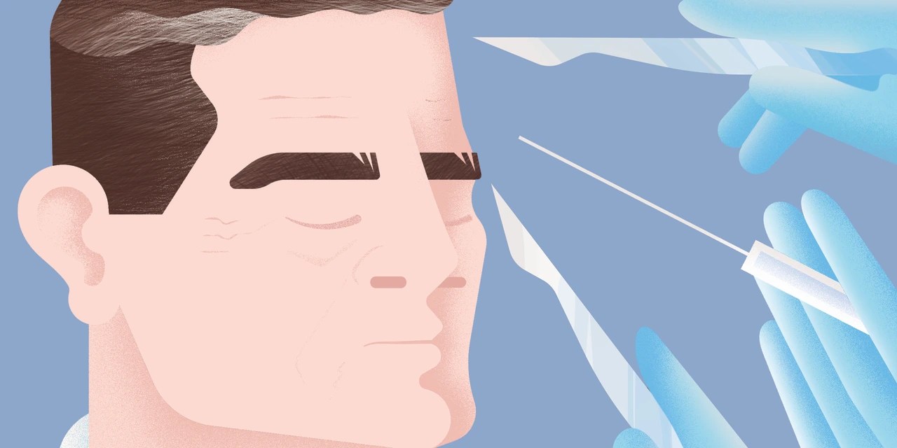 Men’s Facelifts Once a PlasticSurgery Taboo, Now Trendy WSJ