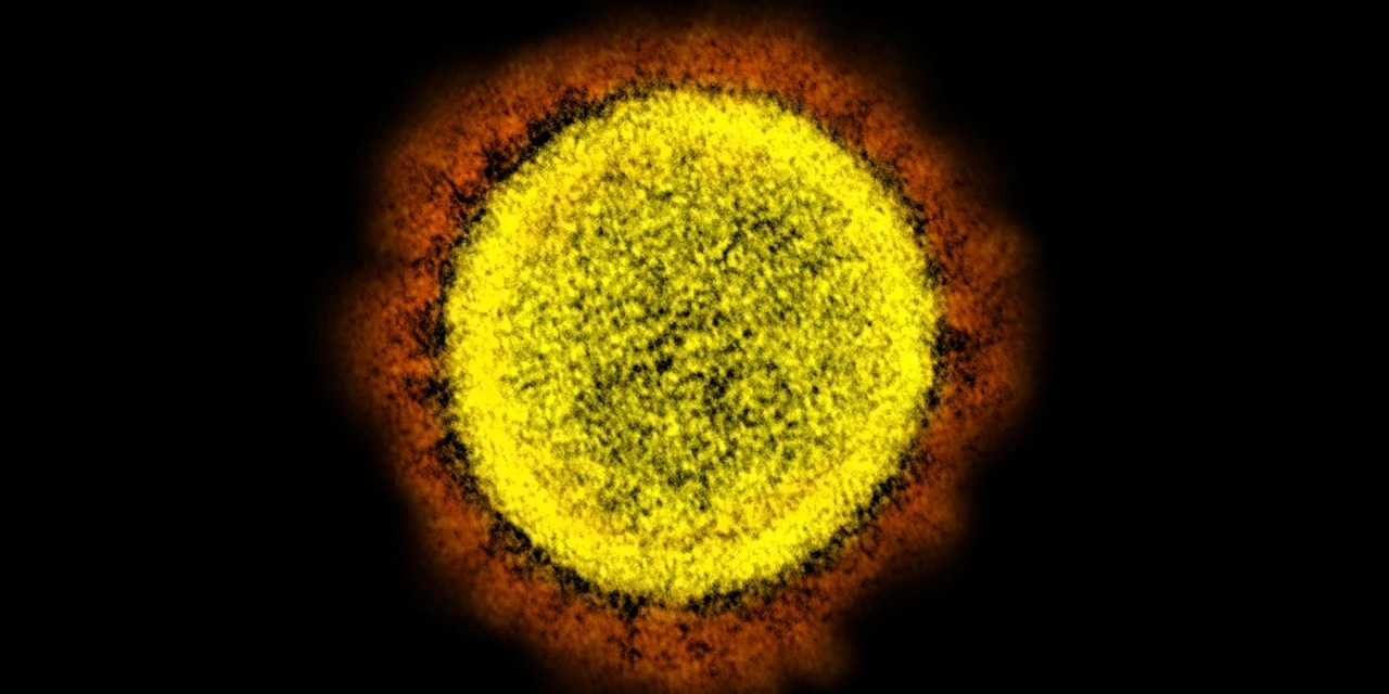 Why the BA.2 Subvariant Could Cause Covid19 Cases to Rise WSJ