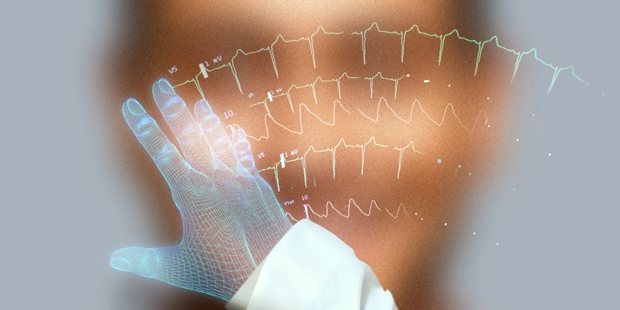 How AI and Facial Recognition Could Spot Stroke and Other Diseases WSJ