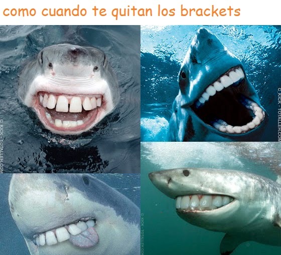 como cuando te quitan los brackets Meme subido por monaguilloman