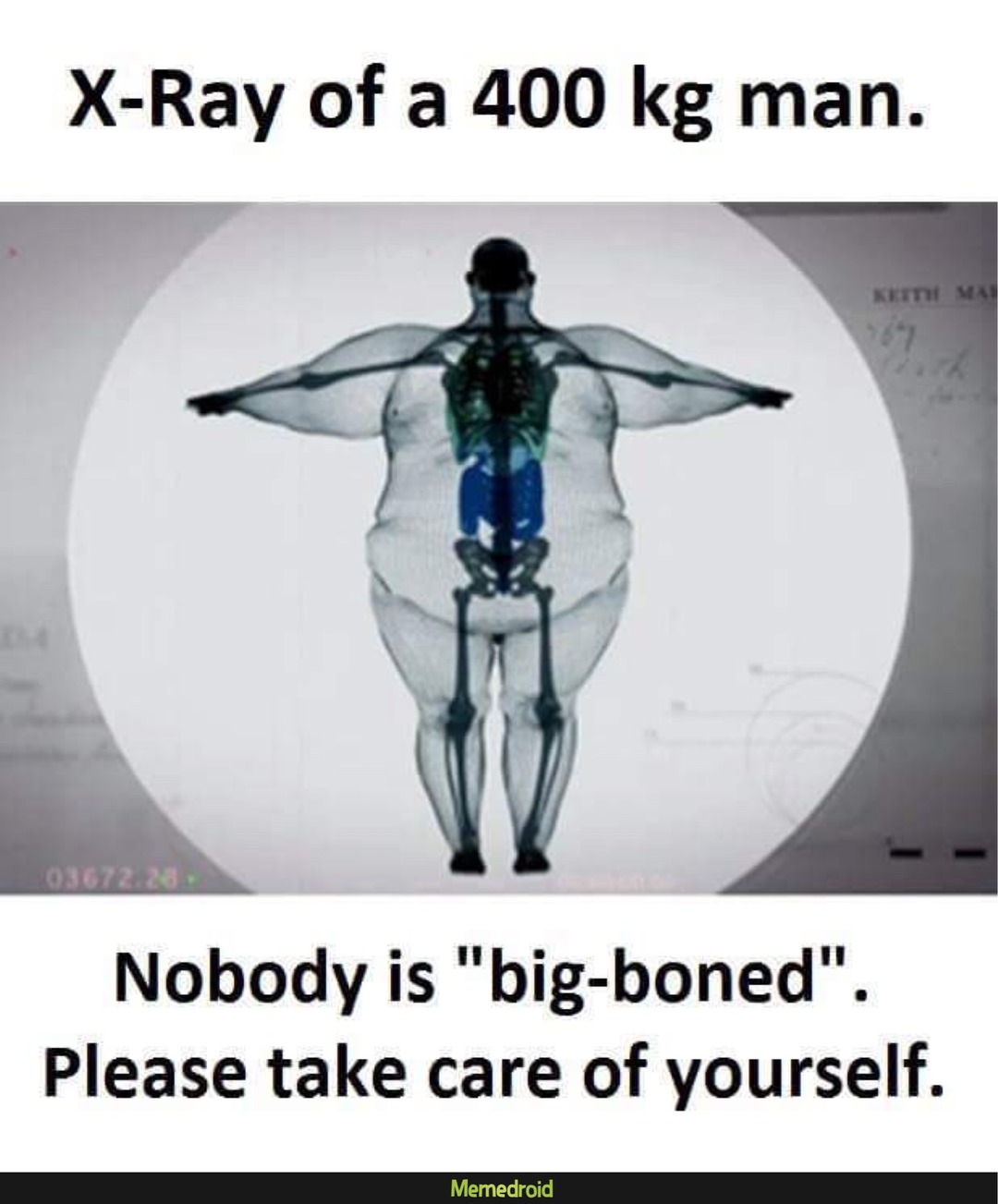 The best XRay memes ) Memedroid