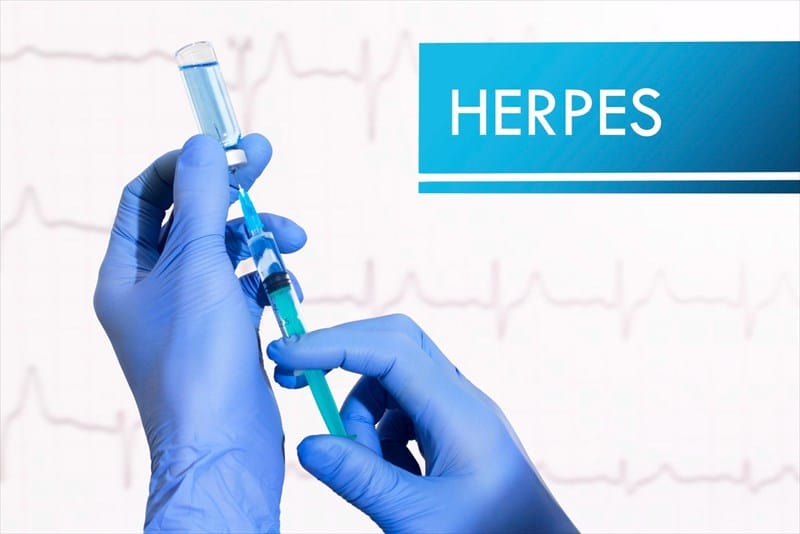 How Long Does The Herpes Virus Survive Outside The Body? Exploring The