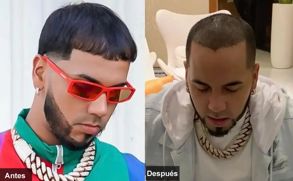 Corte De Peinado De Anuel Aa ideas de peinado